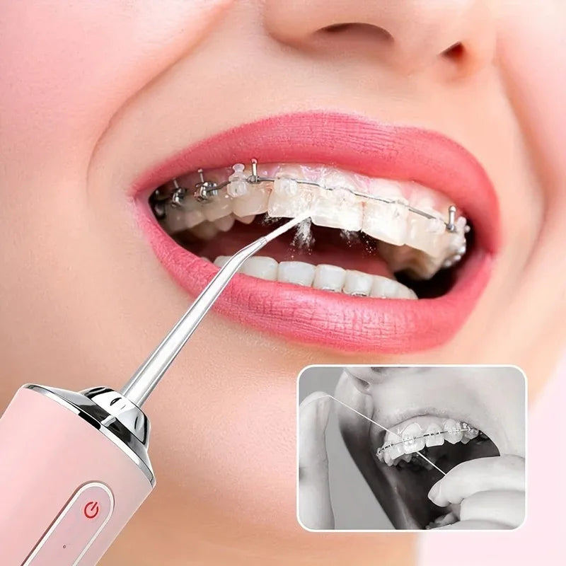 Portable Oral Irrigator – Rechargeable Water Flosser